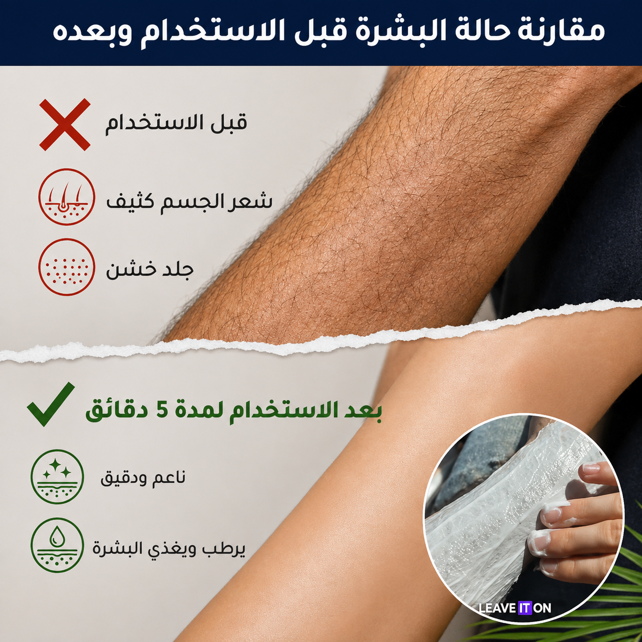 كريم إزالة الشعر بخلاصة زيت جوز الهند النباتي (إزالة الشعر دون ألم)